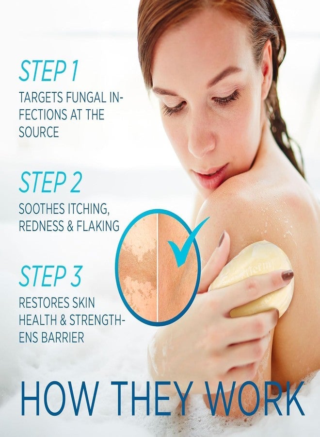 Roycederm Tinea Versicolor Relief Cream & Soap Kit - Helps with Tinea Versicolor, Fungal Skin Conditions – Soothes, Cleanses, and Restores Skin Health - Image 5